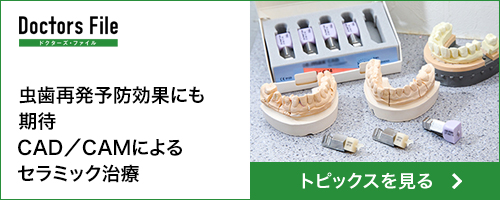 虫歯再発予防効果にも期待 CAD／CAMによるセラミック治療