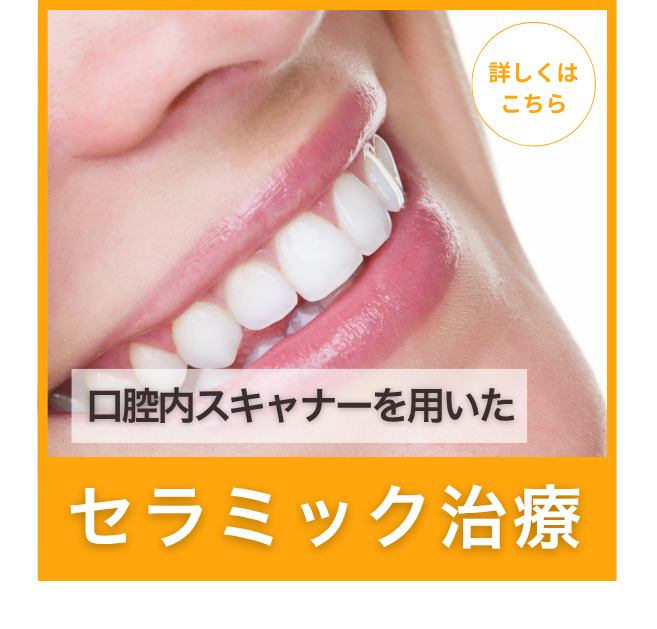 セラミック治療｜型取り不要・最短即日完成｜マリコ歯科クリニック